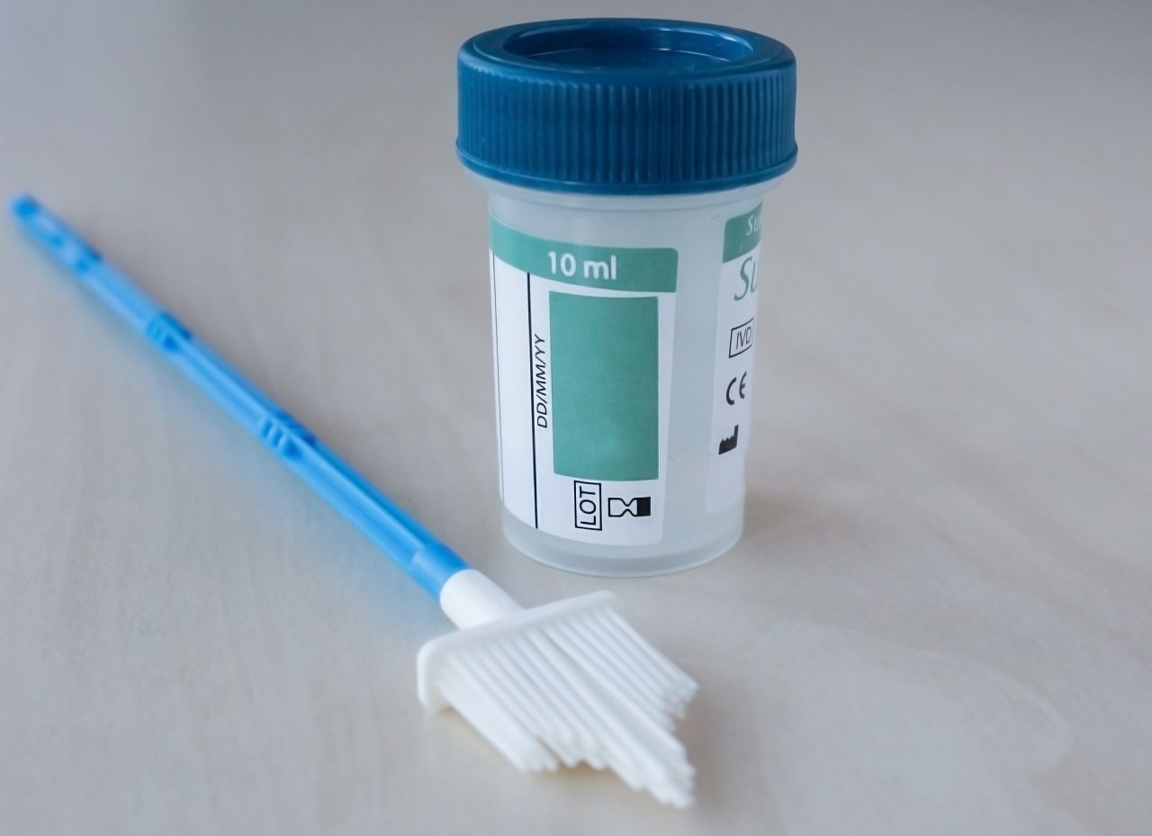 Жидкостная цитология:Революционный подход в медицинской диагностике